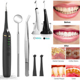 Electric Teeth Cleaning Device